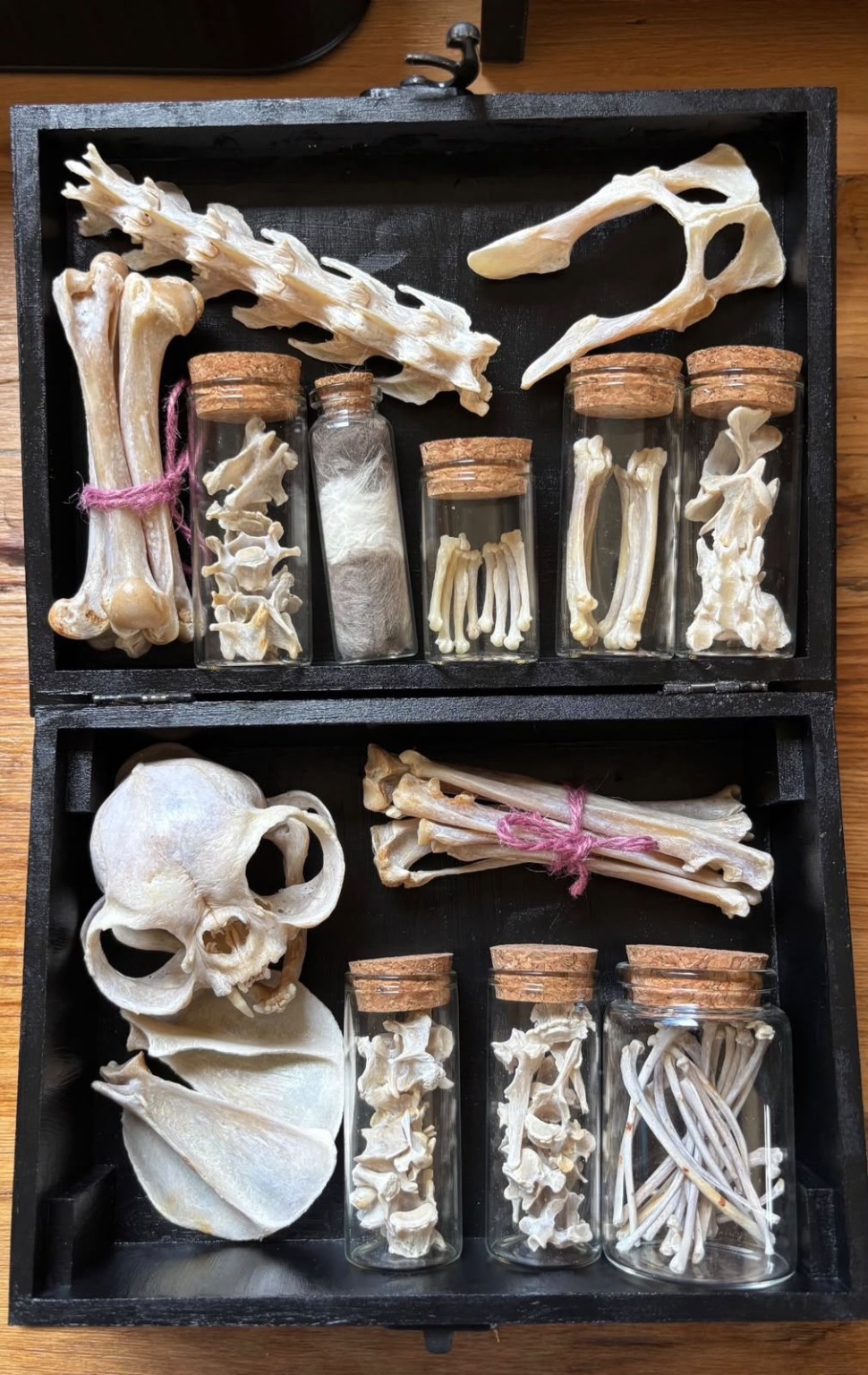 An open black memorial box containing a small skull, carefully arranged bones and corked glass vials.